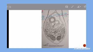 lecture 6  heterophyes heterophyes [upl. by Nujra]