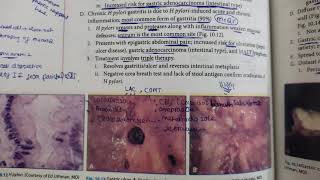 stomach pathology part 2 pathoma [upl. by Novia]