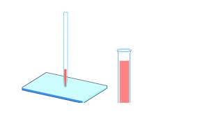 A Human Karyotype Preparation Animation [upl. by Einiar]