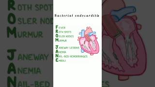 Bacterial endocarditis kattrucate medicalreels bacteria acronym from jane fever anemia [upl. by Ahsenhoj]