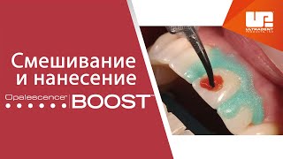 Смешивание и нанесение офисного отбеливания Opalescence™ Boost™ [upl. by Atinar]