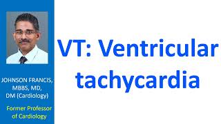 VT Ventricular tachycardia [upl. by Nottap]