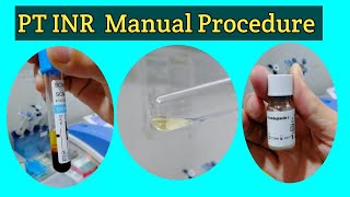 PT INR Manual Procedure Prothrombin Time Test PT Manual Test PT Manual Procedure in Urdu amp Hindi [upl. by Allyson]