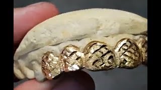 Real Gold Custom Grillz Diamond Cut With Diamond Dust Grills [upl. by Lachance]