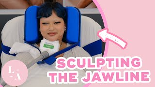 Jada Desiree  Chin CoolSculpting Experience [upl. by Avictor]