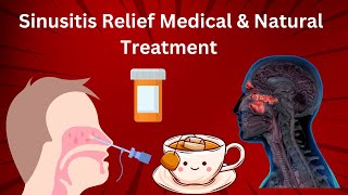 Sinusitis Relief Medical amp Natural Treatment [upl. by Karlie]