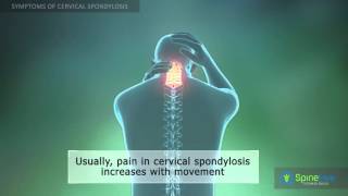 Cervical Spondylosis Symptoms [upl. by Wickman6]