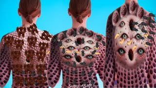 ASMR Deep Cleaning Treatment Animation of Females Back  2d ASMR Animation [upl. by Festa523]