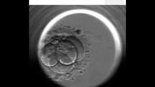 EmbryoScope  artificial fertilization technique [upl. by Okimik]