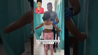 Scoliosis treatment shortsyt short shortfeedtrend [upl. by Peggie]