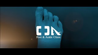 Minimally Invasive Mild Tailors Bunion Surgery [upl. by Romina917]