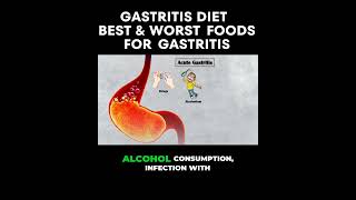 Unlocking the Secrets of Gastritis What You Need to Know [upl. by Zapot]