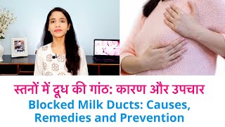 स्तनों में दूध की गांठ कारण और उपचार  Blocked Milk Ducts Causes Remedies and Prevention [upl. by Gow799]