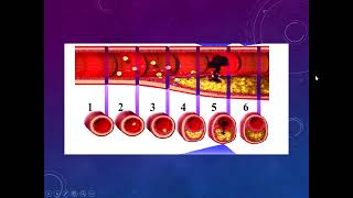 Cardiopatía isquémica II  AngioCardiología  sem 6 [upl. by Seyler]