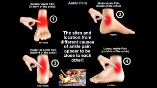 Ankle Pain  Everything You Need To Know  Dr Nabil Ebraheim [upl. by Norma615]