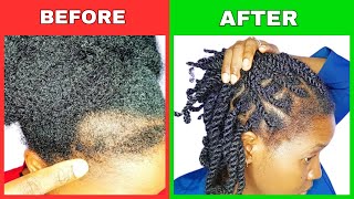 Life Hack  How to Regrow Hair Edges Naturally  Virgin Hair Fertilizer Day 15 hairgrowthchallenge [upl. by Torray]