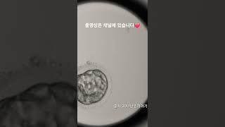 모자이시즘 배아 분열과정 Embryoscope timelapse 시험관 난임 5일배양 모자이시즘 pgt염색체 배아분열과정 [upl. by Arthur]