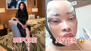 Plastic surgery gone wrong❓❓khanyi Mbau’s new look scares fans 😳😳😳 [upl. by Enomal]