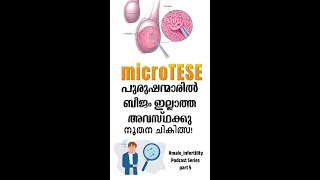 Male Infertility Treatment MicroTESE Explained by Experts  Cochin Urology Podcast  Part 5 [upl. by Anot]