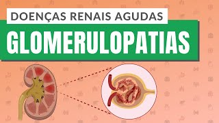 DOENÇAS RENAIS AGUDAS  PARTE 1 Glomerulopatias [upl. by Anoet]