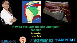 ¿Como evaluar la cápsula articular del hombro Dra Lena Pari [upl. by Nivag]