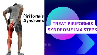 UNDERSTAND PIRIFORMIS SYNDROME  PIRIFORMIS STRETCHING EXERCISES  PIRIFORMIS STRENGTHEN and massage [upl. by Ahsenom]