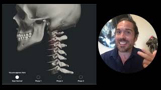 4 Signs of a Neck Problem  Prevention or Crisis  Upper Cervical Chiropractor Spokane [upl. by Doreg]