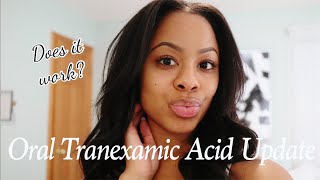 Oral Tranexamic Acid Update Results Side Effects Skin Ceuticals Vitamin C Before amp After Photos [upl. by Miquela]