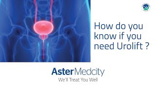 Am I eligible for UroLift a daycare nonsurgical procedure to enlarged prostate condition [upl. by Prussian723]