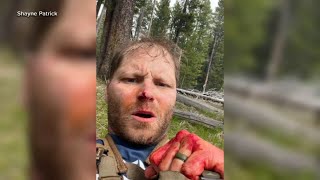 Veteran speaks out after fighting off grizzly bear while on honeymoon [upl. by Prunella]