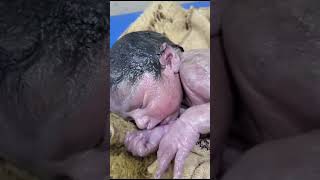 Vernix caseosaknown as vernix is the waxy white substance found coating the skin newborn human baby [upl. by Uriiah]