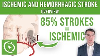 Overview of Ischemic and Hemorrhagic Stroke  Lecturio [upl. by Spencer]