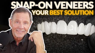 Smile Makeover Results Our Snapon Veneer is Your BEST Solution [upl. by Catto333]