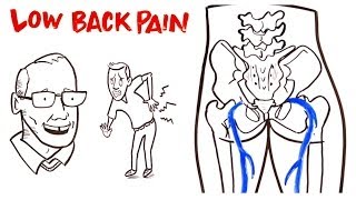 Low Back Pain [upl. by Omura]