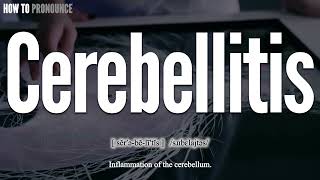 Cerebellitis Pronunciation  How to Pronounce say Cerebellitis CORRECTLY  Meaning Definition [upl. by Erej]