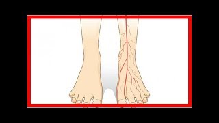 Conseils pratiques pour soulager la mauvaise circulation sanguine dans les jambes [upl. by Eno]