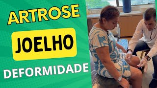 DEFORMIDADE NO JOELHO  ARTROSE HÁ MAIS DE 26 ANOS  artrose joelho fisioterapia acupuntura [upl. by Fredra]