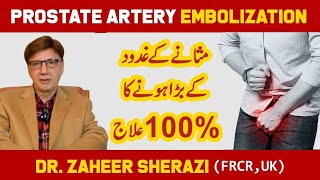 Say Goodbye to Enlarged Prostate  Prostatic Artery Embolization in Lahore  Masana ki gadod ka ilaj [upl. by Eliathan407]