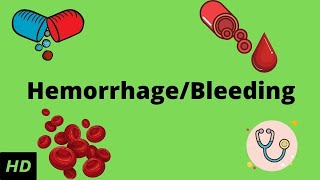 Hemorrhage bleeding Causes Signs and Symptoms Diagnosis and Treatment [upl. by Aidin296]