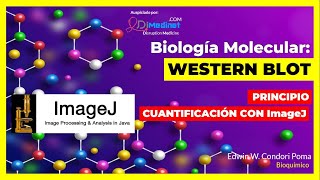 🟢 WESTERN BLOTT PARA DETECTAR PROTEÍNAS y UN SOFTWARE PARA CUANTIFICAR 🧪🔬🤓 [upl. by Eidassac]