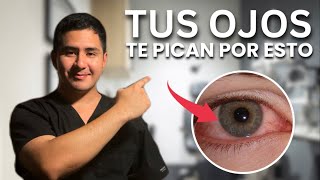 ✅ Como Tratar la PICAZÓN en los OJOS Explicado por un Doctor [upl. by Anal]