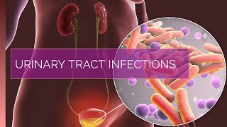 3D Animation of Urinary Tract Infections  SignsSymptoms amp Treatment [upl. by Seana]