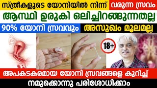 90 യോനി സ്രവവും അസുഖം മൂലമല്ല അപകടകരമായ യോനി സ്രവങ്ങളെ കുറിച്ച് നമുക്കൊന്നു പരിശോധിക്കാംISRM [upl. by Enahs]