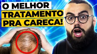 QUAL MELHOR TRATAMENTO PARA QUEDA DE CABELO MASCULINO [upl. by Davidde759]