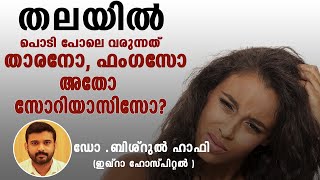 തലയിൽ പൊടി പോലെ വരുന്നത് താരനോ ഫംഗസോ അതോ സോറിയാസിസോ Psoriasis decoded episode 7 DrBishurul Hafi [upl. by Emmi333]