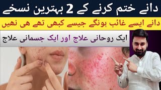 acne control treatment acne pimples remove face wash  dany khatam karne ka best tarika [upl. by Ryder125]