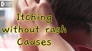 What causes itching all over without a rash  Dr Rasya Dixit [upl. by Pega]