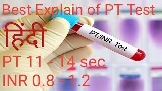 PT INR TEST IN HINDI [upl. by Lovel]