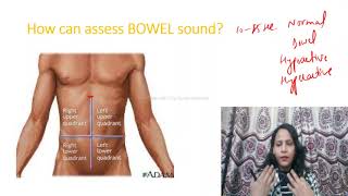 How to Assess BOWEL SOUNDProcedure of bowel Sound assessment AUSCULTATION OF ABDOMEN BORBORYGMUS [upl. by Acino643]