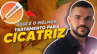 MELHOR TRATAMENTO PARA CICATRIZ QUELOIDE [upl. by Litsyrk]